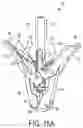 Fig. 10 - Gripper pusher mechanism for tissue apposition systems