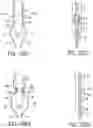 Fig. 13 - Gripper pusher mechanism for tissue apposition systems