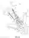 Fig. 36 - Gripper pusher mechanism for tissue apposition systems