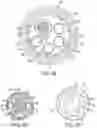 Fig. 41 - Gripper pusher mechanism for tissue apposition systems