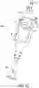 Fig. 44 - Gripper pusher mechanism for tissue apposition systems