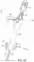 Fig. 46 - Gripper pusher mechanism for tissue apposition systems