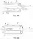 Fig. 48 - Gripper pusher mechanism for tissue apposition systems