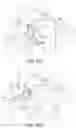Fig. 53 - Gripper pusher mechanism for tissue apposition systems