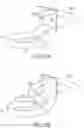 Fig. 55 - Gripper pusher mechanism for tissue apposition systems
