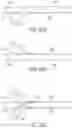 Fig. 57 - Gripper pusher mechanism for tissue apposition systems