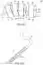 Fig. 63 - Gripper pusher mechanism for tissue apposition systems