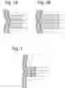 Fig. 03 - Instrument for performing anastomosis
