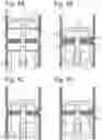 Fig. 04 - Instrument for performing anastomosis