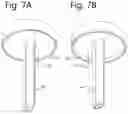 Fig. 07 - Instrument for performing anastomosis