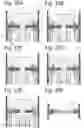Fig. 10 - Instrument for performing anastomosis