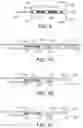 Fig. 04 - Methods and devices for controlling the size of emphysematous bullae