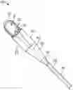 Fig. 01 - STONE RETRIEVAL BALLOON CATHETER