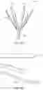 Fig. 11 - STONE RETRIEVAL BALLOON CATHETER