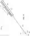 Fig. 19 - STONE RETRIEVAL BALLOON CATHETER