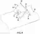 Fig. 05 - IMPLANT EXCISION AID