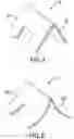 Fig. 08 - IMPLANT EXCISION AID