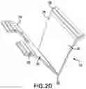 Fig. 15 - IMPLANT EXCISION AID