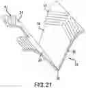 Fig. 16 - IMPLANT EXCISION AID