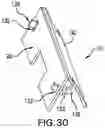 Fig. 20 - IMPLANT EXCISION AID