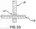 Fig. 23 - IMPLANT EXCISION AID