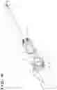 Fig. 07 - Load sensing resection device