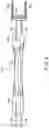 Fig. 10 - Surgical procedure of knee joint