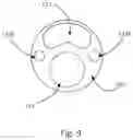 Fig. 10 - Scoring balloon with translating scoring wires
