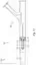 Fig. 13 - Scoring balloon with translating scoring wires