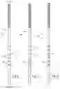 Fig. 05 - VARIABLE STIFFNESS NEEDLE