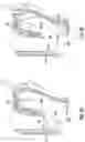 Fig. 30 - Sealing multiple surgical instruments