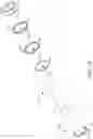 Fig. 03 - Minimally invasive specimen retrieval system and methods thereof