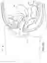 Fig. 18 - Minimally invasive specimen retrieval system and methods thereof