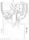 Fig. 19 - Minimally invasive specimen retrieval system and methods thereof