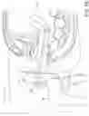 Fig. 22 - Minimally invasive specimen retrieval system and methods thereof