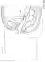 Fig. 24 - Minimally invasive specimen retrieval system and methods thereof