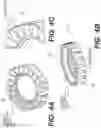 Fig. 06 - Self in-fusing pedicle screw implant