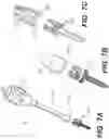 Fig. 11 - Self in-fusing pedicle screw implant