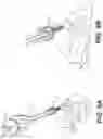 Fig. 14 - Self in-fusing pedicle screw implant