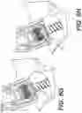 Fig. 17 - Self in-fusing pedicle screw implant