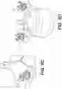 Fig. 19 - Self in-fusing pedicle screw implant