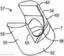 Fig. 01 - Pivotal bone anchor assembly with bottom loaded insert and pivotless retainer