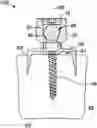 Fig. 01 - Systems for treatment of spinal deformities