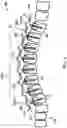 Fig. 02 - Systems for treatment of spinal deformities