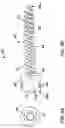 Fig. 05 - Systems for treatment of spinal deformities