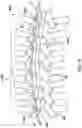 Fig. 10 - Systems for treatment of spinal deformities