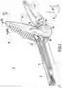 Fig. 03 - ACCESSORY FOR TENSIONING AN ELONGATE ELEMENT