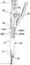 Fig. 01 - Instrument for locking and unlocking a head of a bone anchor in a polyaxial bone anchoring device