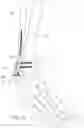 Fig. 19 - FLEXIBLE BONE IMPLANT