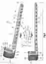 Fig. 03 - Bone fixation system including an implant having a plate portion and a mesh portion